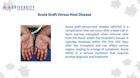 Acute graft.